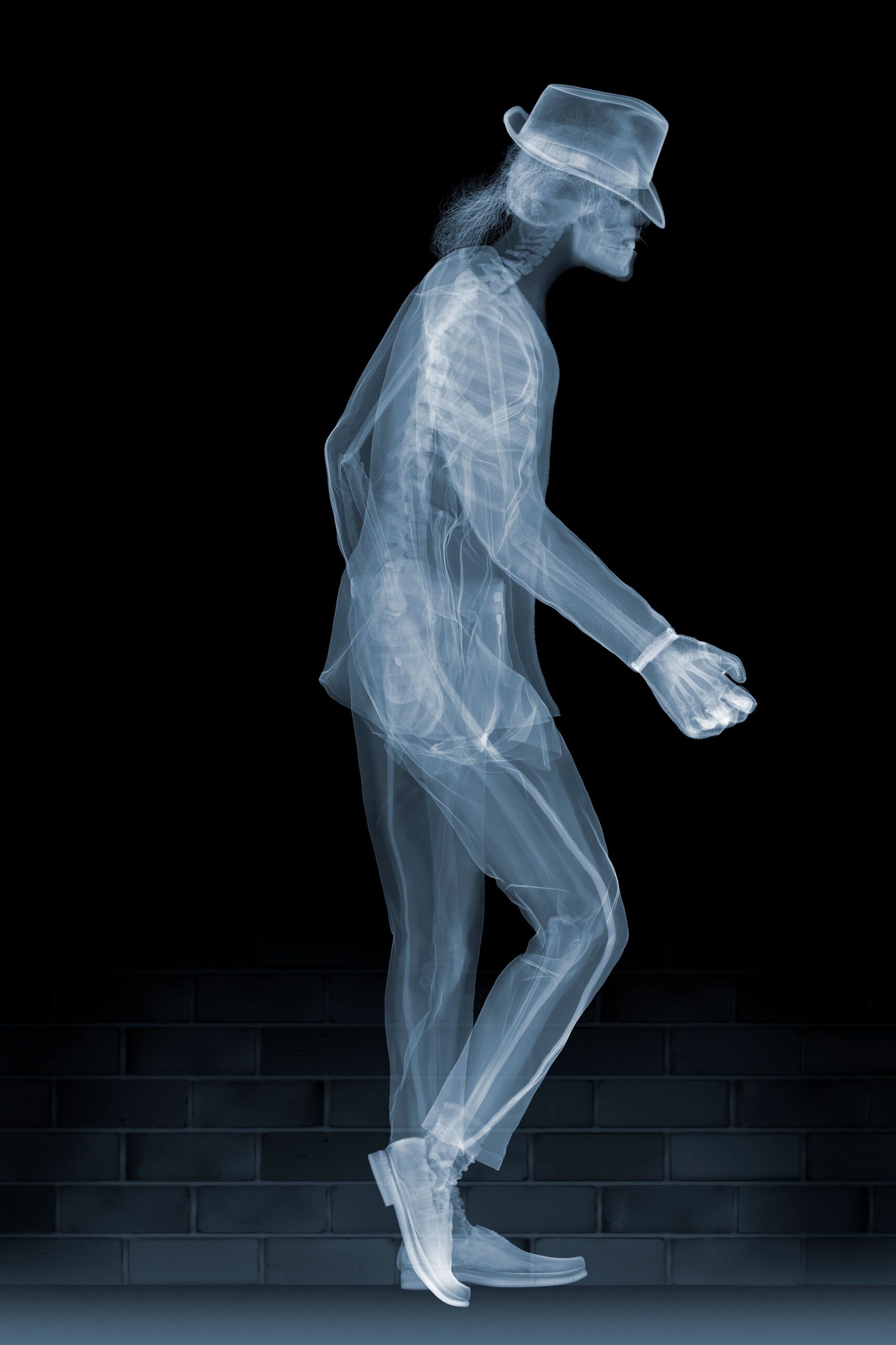 X Ray Art Prints At Michael Partin Blog X Ray Art Prints At Michael Partin Blog